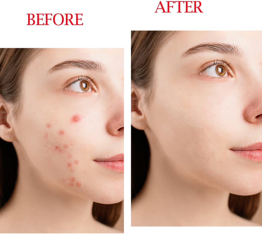 I Will Professionally Remove Dark Spots, Pimples Removes