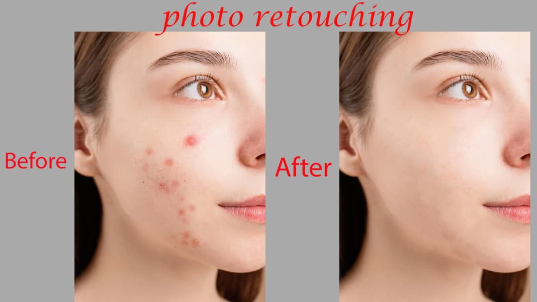 I Will Professionally Remove Dark Spots, Pimples Removes.